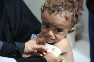 L’assistenza umanitaria continua ad evitare una gigantesca catastrofe umana in Yemen, ma non è sufficiente