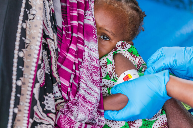 Allarme carestie: fame, malnutrizione e come il WFP affronta questa mortale pandemia