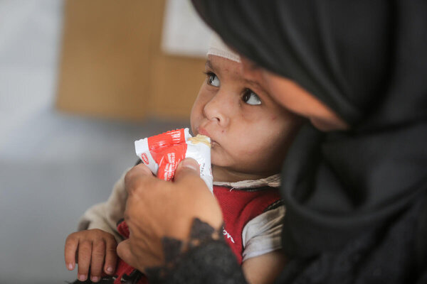 Photo: WFP/Ali Jadallah. Child attending their weekly or biweekly check-ups with Action Against Hunger (ACF), a key implementing partner of WFP. Palestine, Gaza city. 