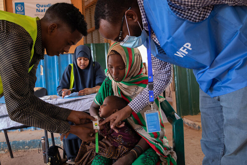 baby is checked for malnutrition at a clinic_Somalia