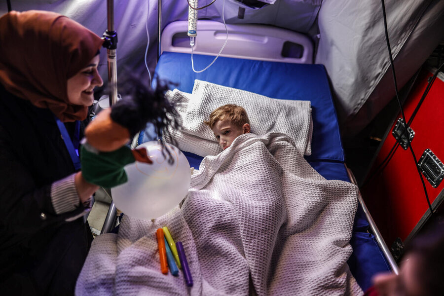 Child showing signs of malnutrition in field hospital in Gaza