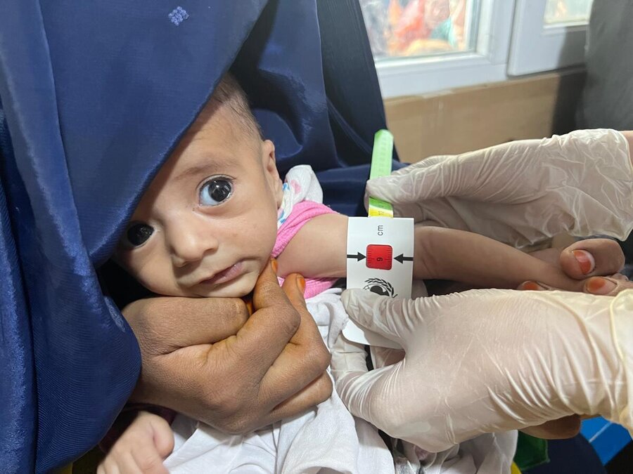 A seven-month-old child undergoes as malnutrition arm measurement in Kabul