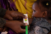Misurazione della circonferenza del braccio a una bambina in Somalia che mostra un livello moderato di malnutrizione. WFP/Samantha Reinders