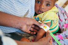Misurazione della circonferenza del braccio (MUAC) di un bambino somalo. 